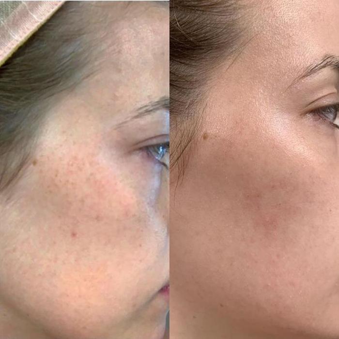 Pure Vanity - Peoria, AZ