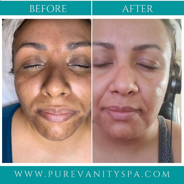 Pure Vanity - Peoria, AZ