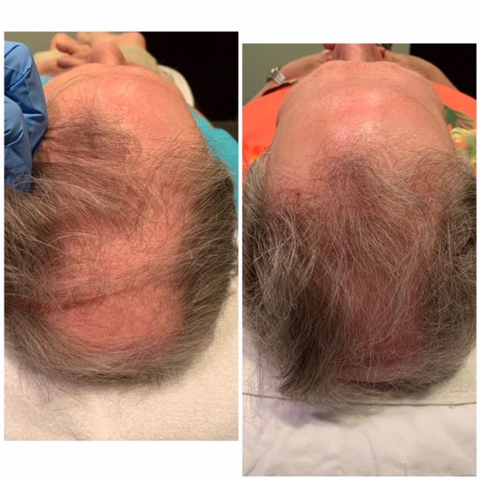 Pure Vanity - Peoria, AZ