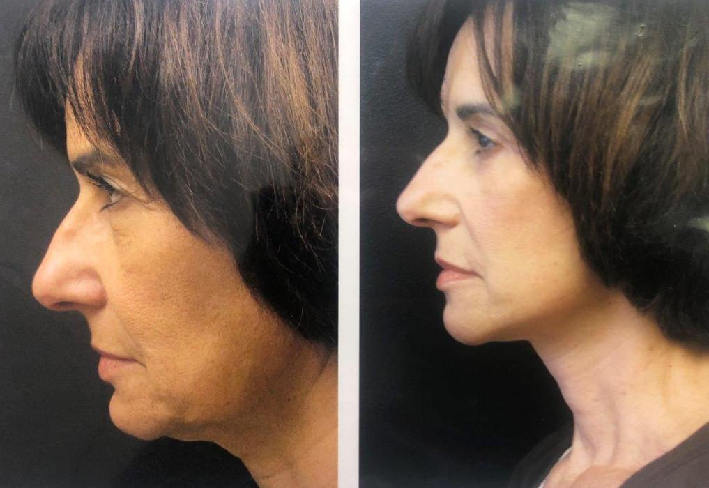 Finger Lakes ENT & Skin Oncology: Douglas W. Halliday, MD, Ph.D. - Skaneateles, NY