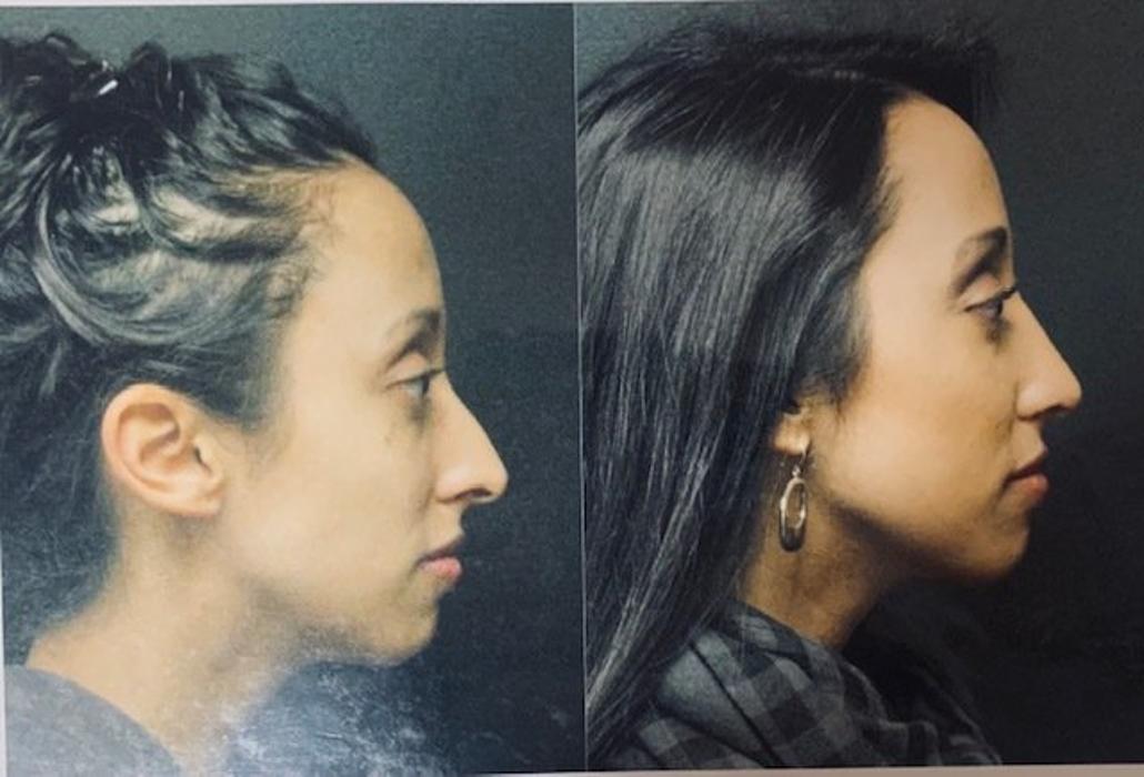 Finger Lakes ENT & Skin Oncology: Douglas W. Halliday, MD, Ph.D. - Skaneateles, NY