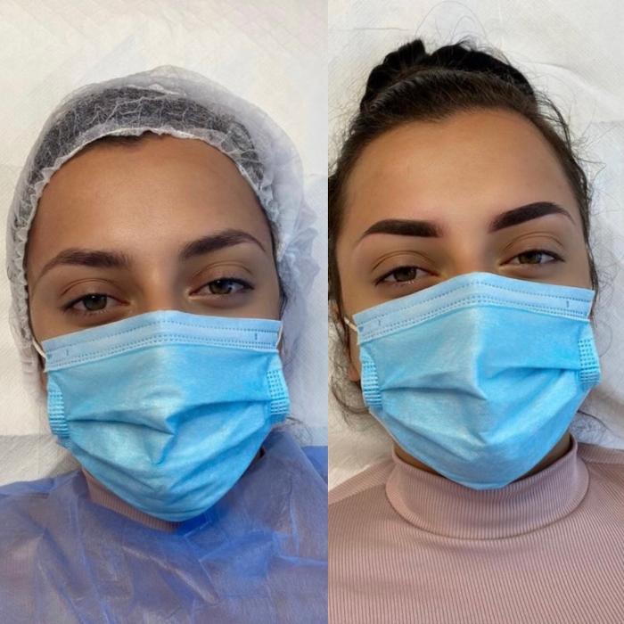 Fotos - BrowBabe Microblading - 22