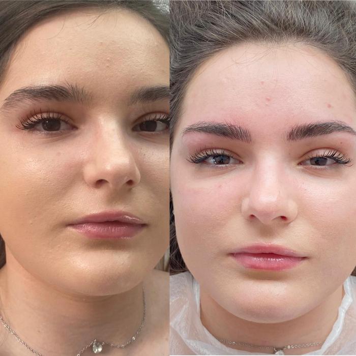 Fotos - BrowBabe Microblading - 27