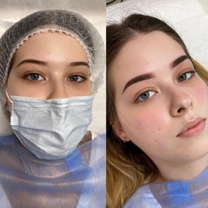 Fotos - BrowBabe Microblading - 21