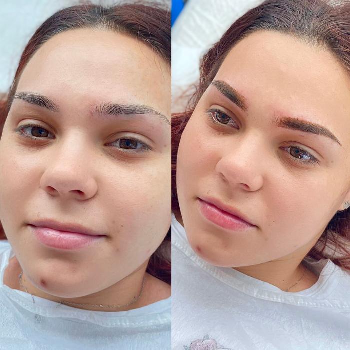 Fotos - BrowBabe Microblading - 19