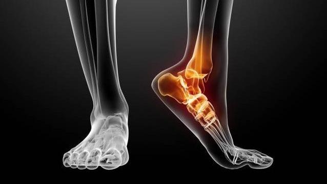 Orthopädie Technik Bartel GmbH & Co. KG, Schumannstraße in Bonn