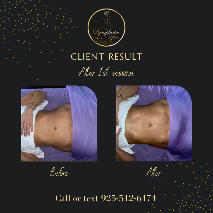 Lymphatic Glow - San Ramon, CA