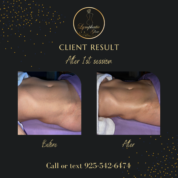 Lymphatic Glow - San Ramon, CA