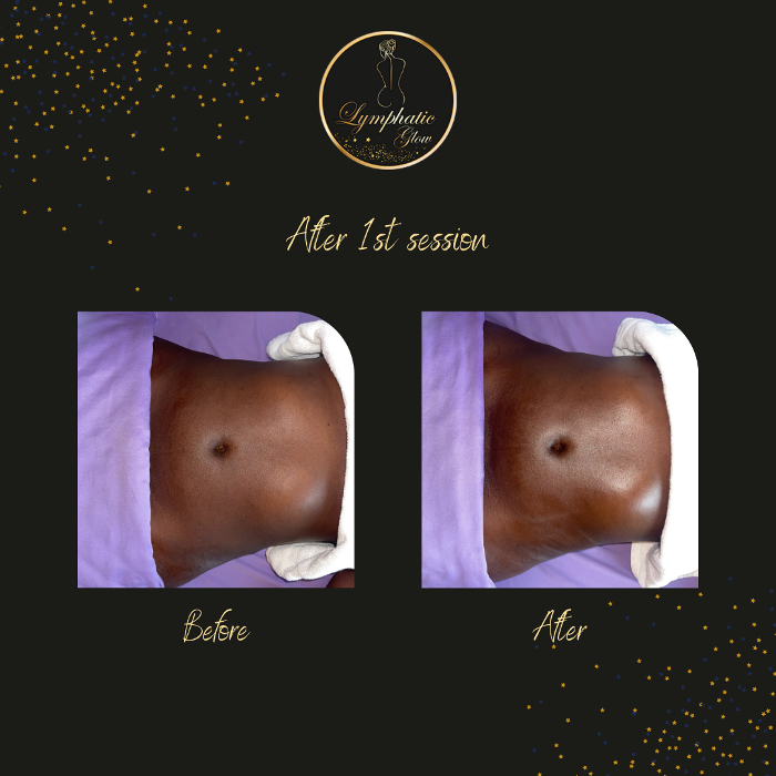 Lymphatic Glow - San Ramon, CA