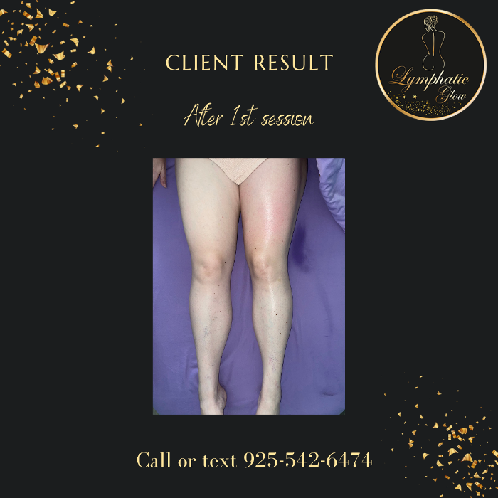 Lymphatic Glow - San Ramon, CA