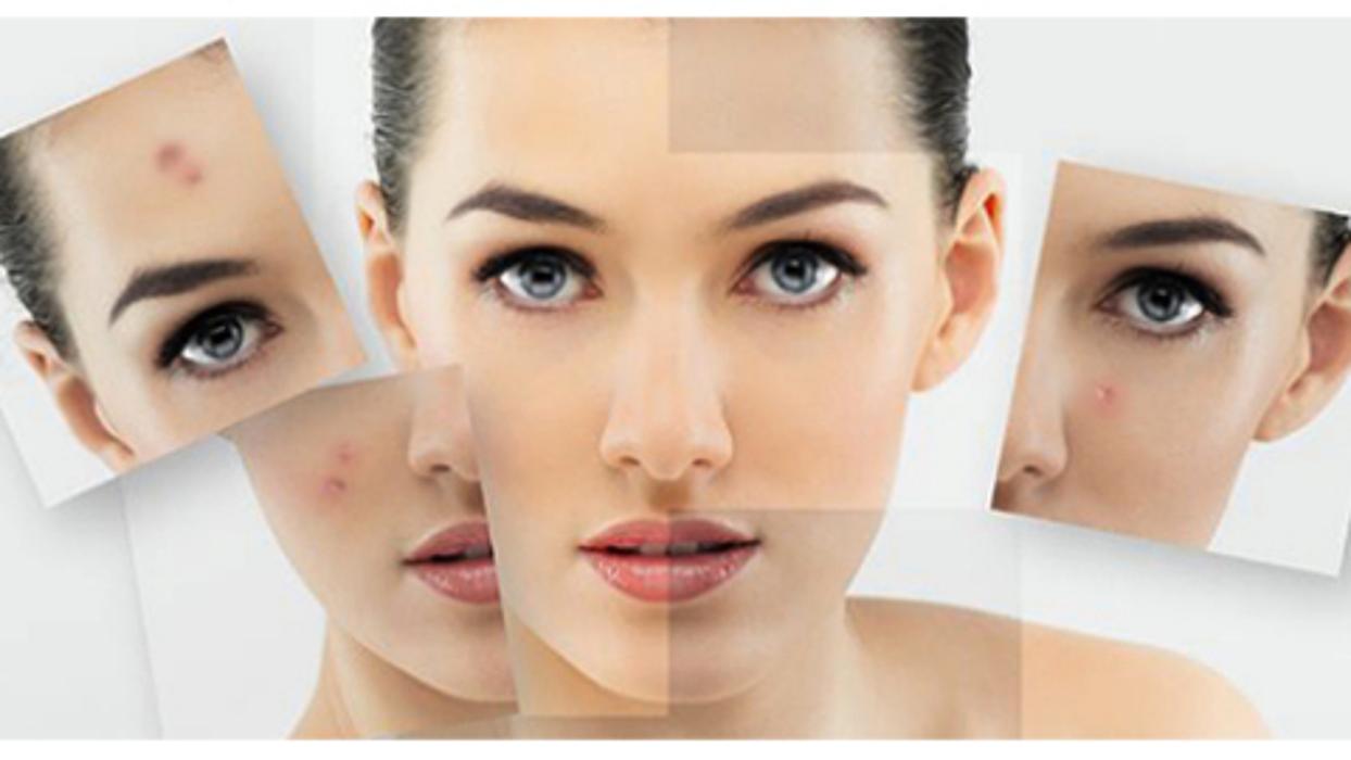 Boston Acne Specialists - Cambridge, MA
