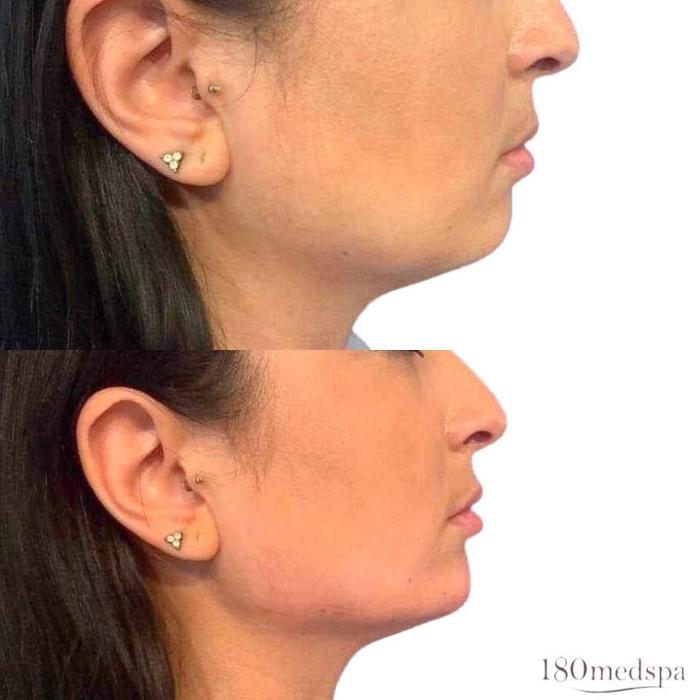 180 medspa - Winter Park, FL