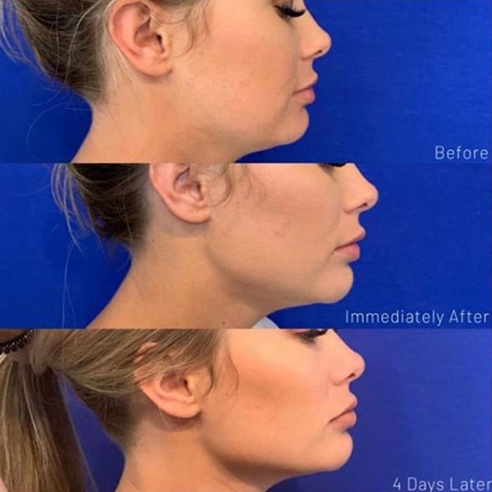 180 medspa - Winter Park, FL