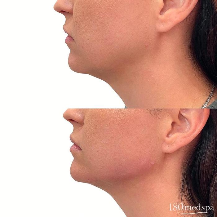 180 medspa - Winter Park, FL