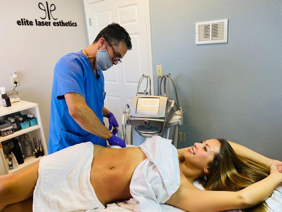 Elite Laser Esthetics - Miami Lakes, FL