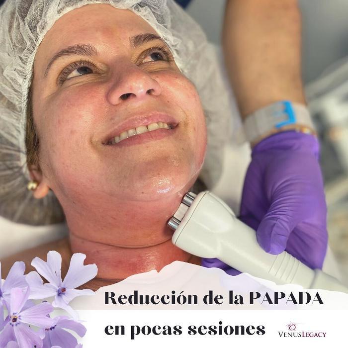 Elite Laser Esthetics - Miami Lakes, FL