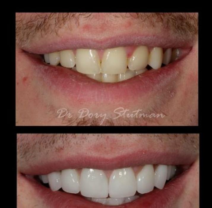 South Shore Dental Care - Massapequa Park, NY