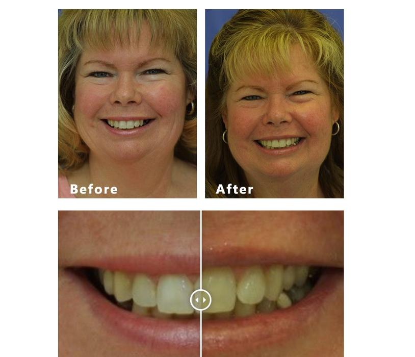 David A. Rice, DDS - Elgin, IL