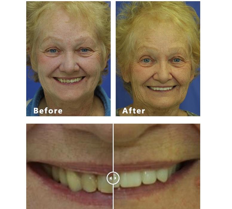 David A. Rice, DDS - Elgin, IL