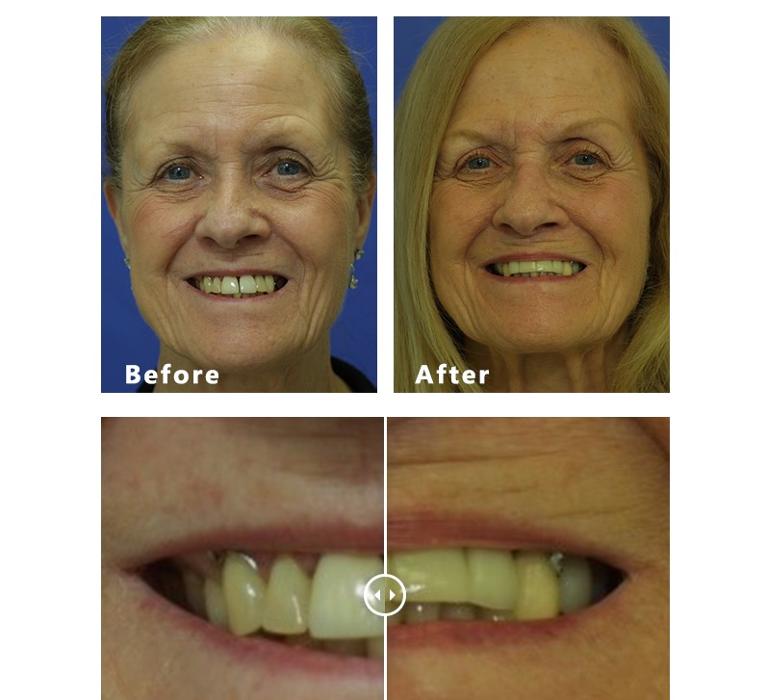 David A. Rice, DDS - Elgin, IL