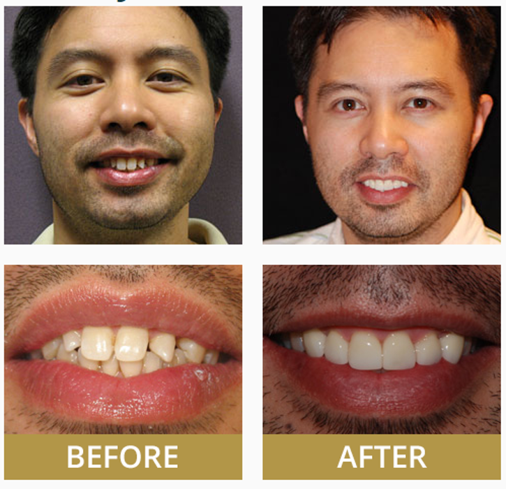 The Addison Dentist - Addison, TX