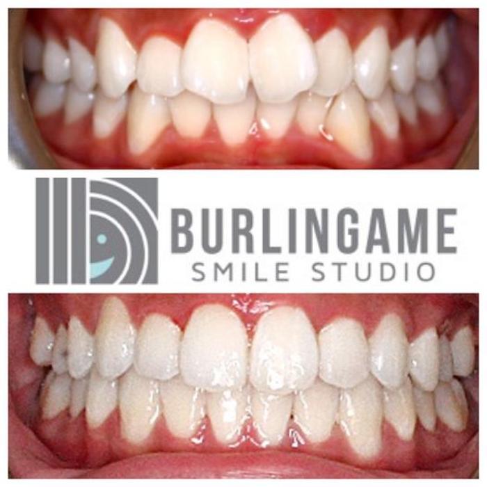 Burlingame Smile Studio Orthodontist April Lee DDS MS Image