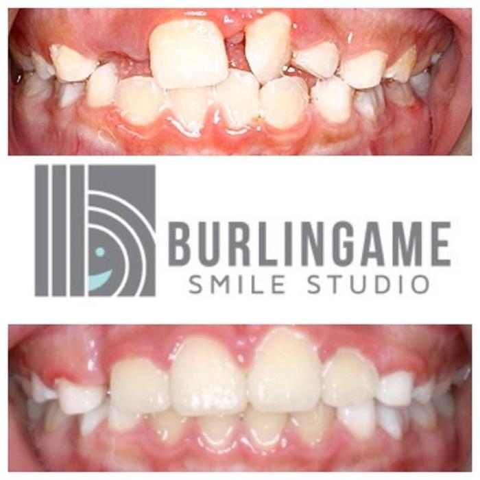 Burlingame Smile Studio Orthodontist April Lee DDS MS Image