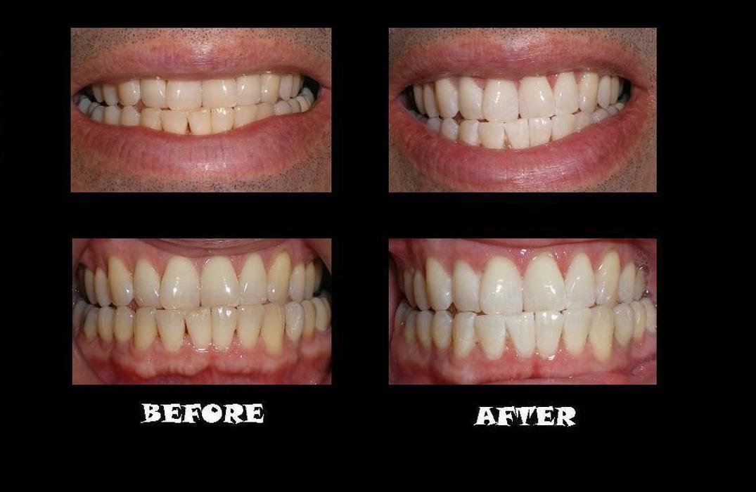 Designer Smiles Image