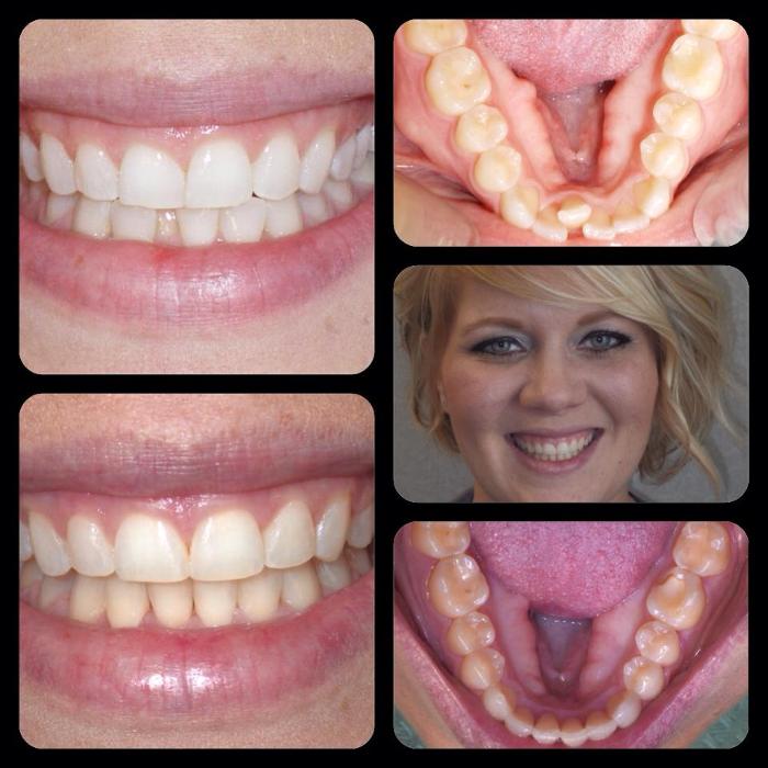 Designer Smiles Image