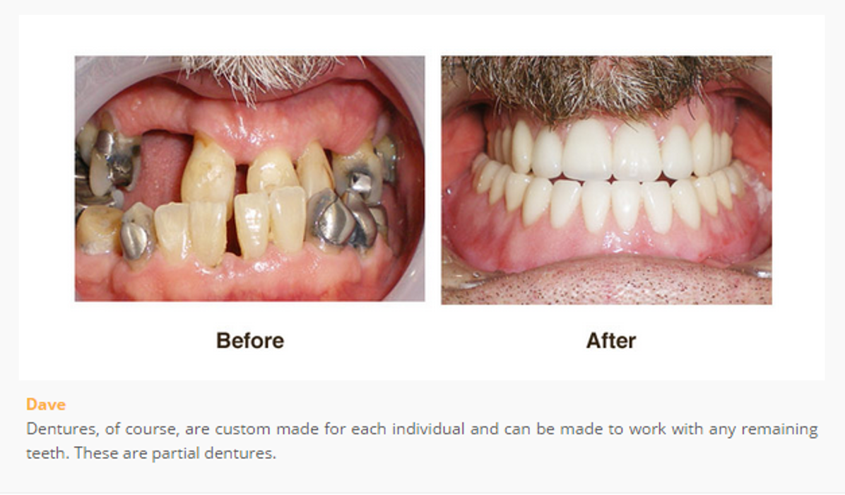 Designer Smiles Image