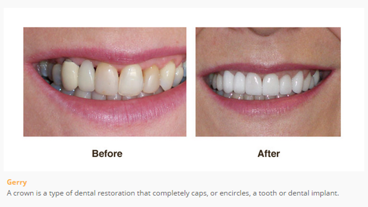 Designer Smiles Image