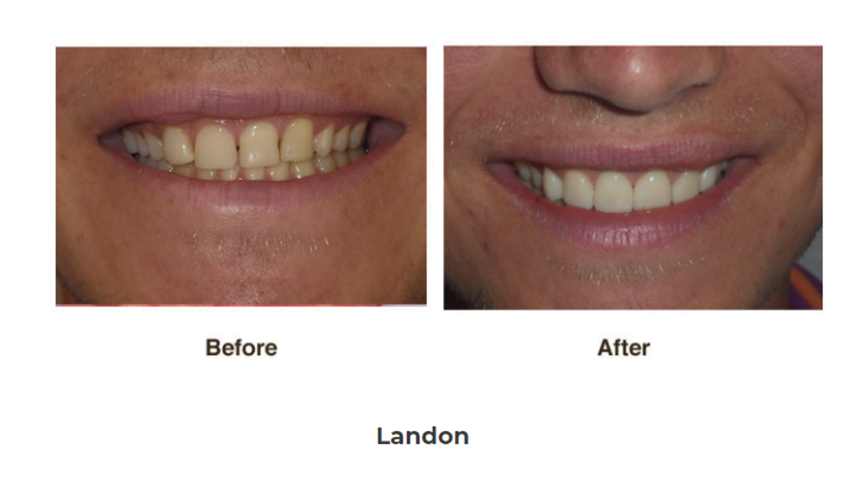 Designer Smiles Image