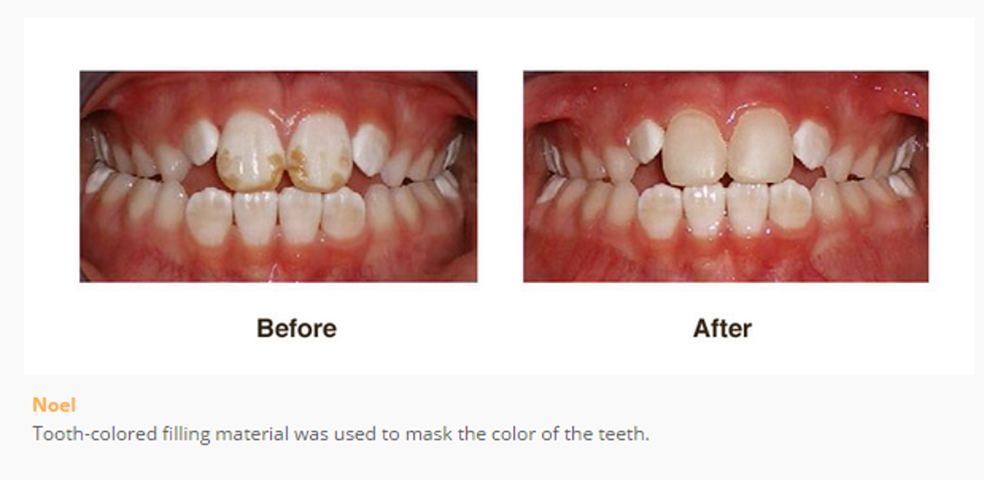 Designer Smiles Image