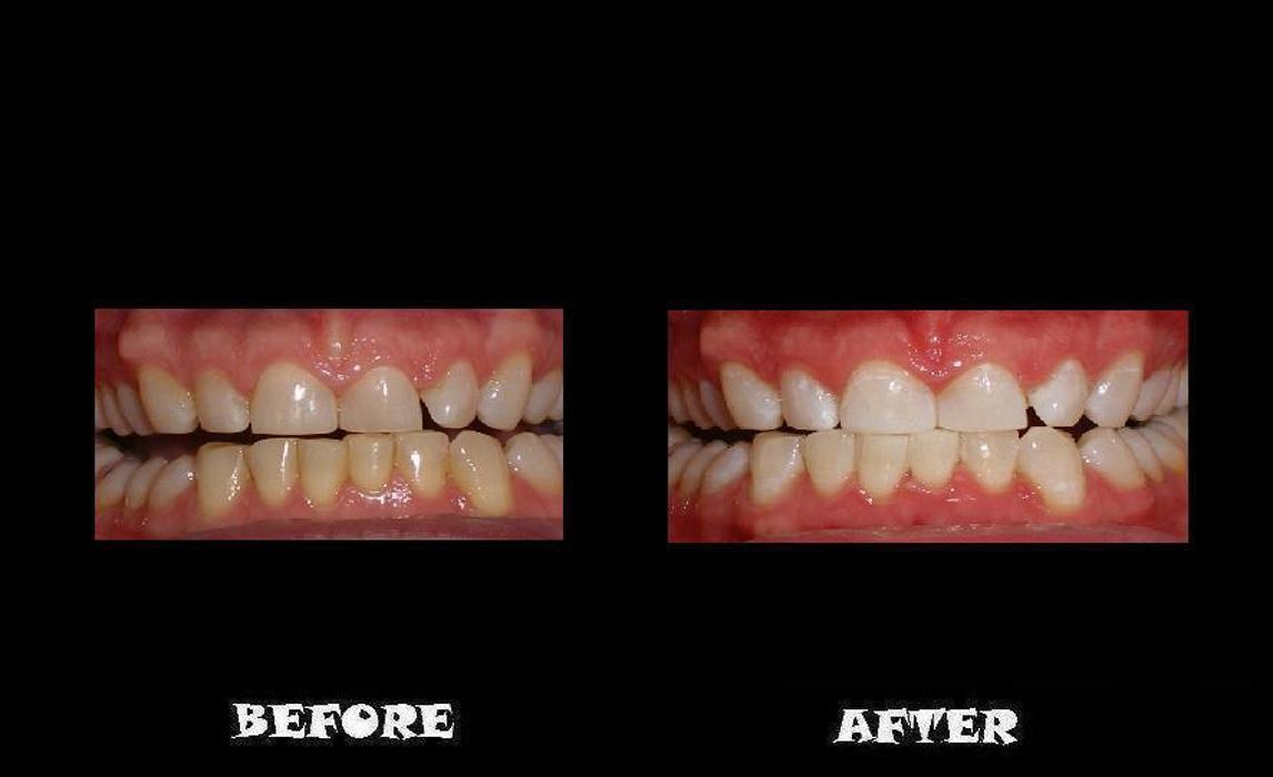 Designer Smiles Logo