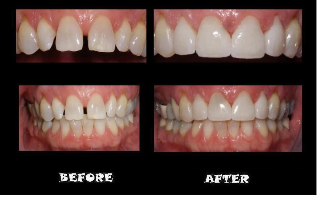 Designer Smiles Image