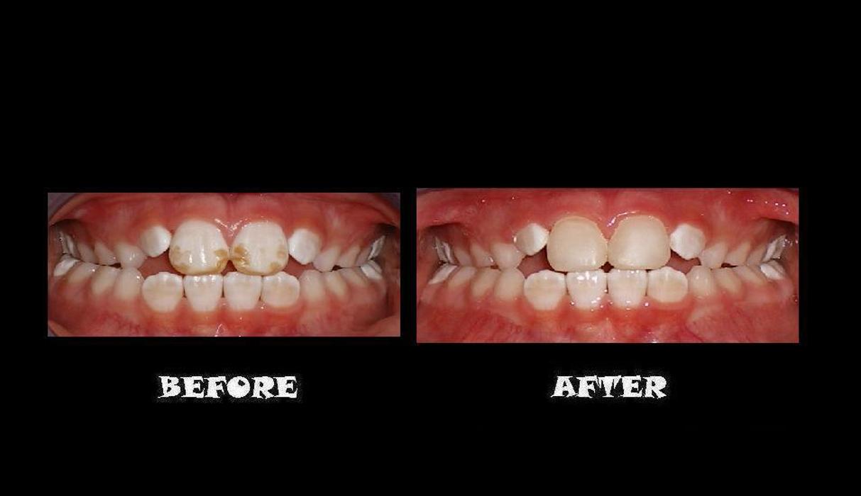 Designer Smiles Image