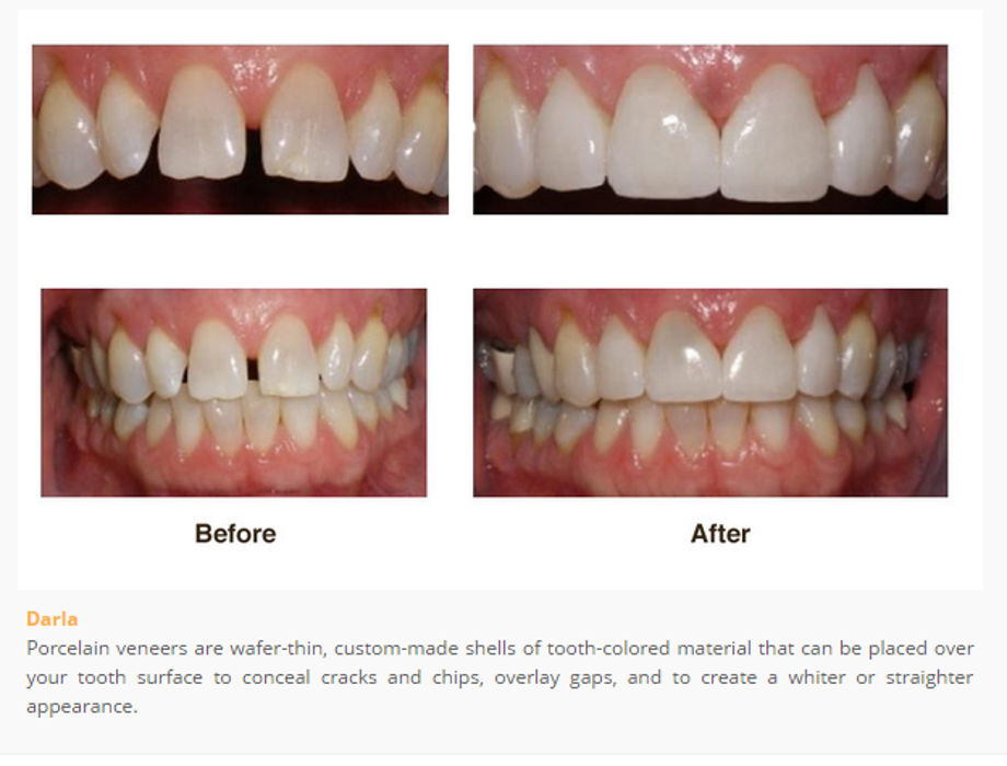 Designer Smiles Image