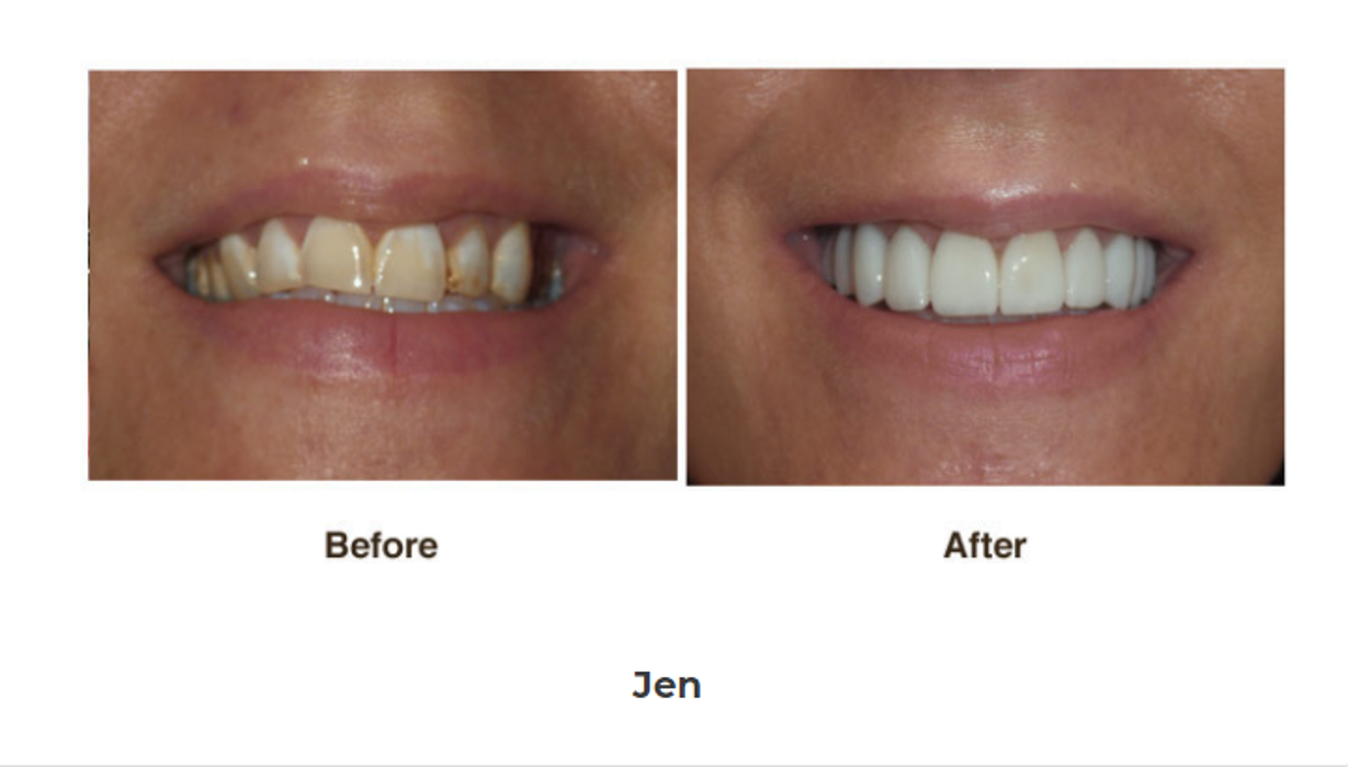 Designer Smiles Image