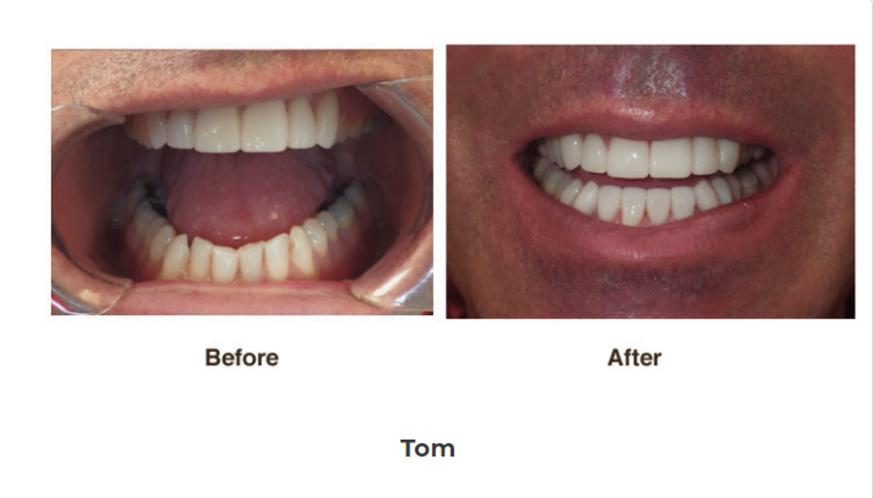 Designer Smiles Image