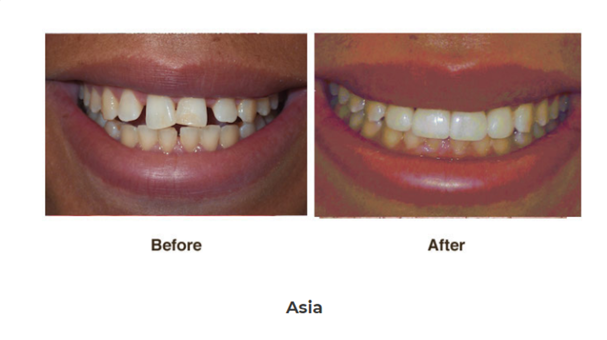 Designer Smiles Image