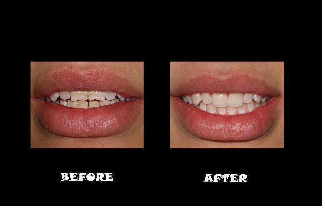 Designer Smiles Image