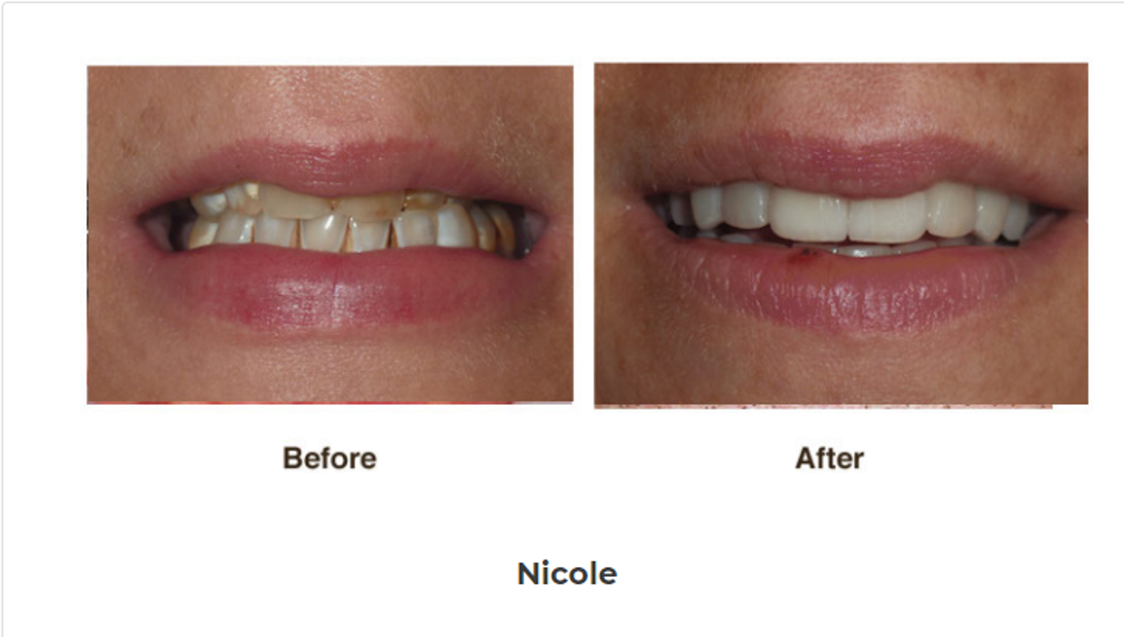 Designer Smiles Image