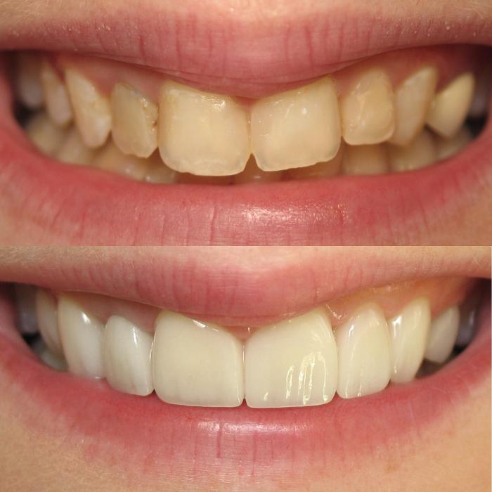 Future of Dentistry at Willows - North Andover Image