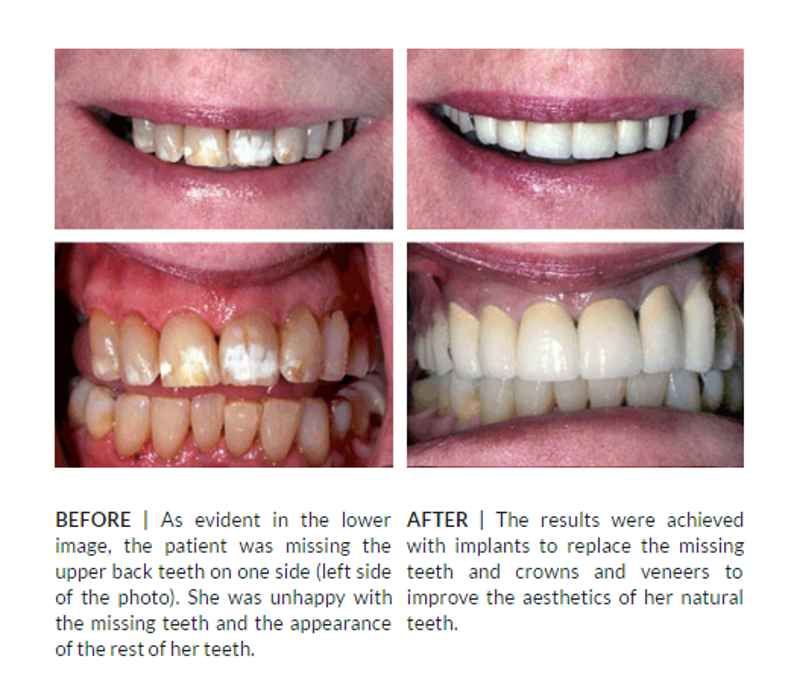 Mirelez Wellness Dental Logo