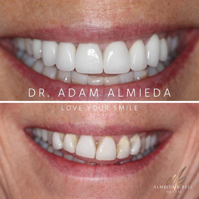 Almeida &amp; Bell Dental Lone Tree - General, Cosmetic, and Implant Dentistry Logo