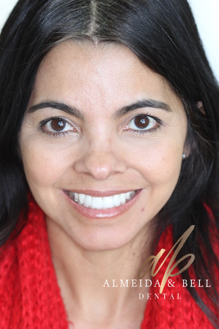 Almeida & Bell Dental Lone Tree - General, Cosmetic, and Implant Dentistry Image