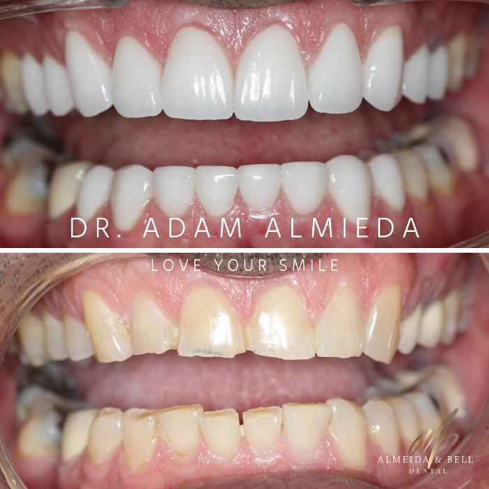Almeida & Bell Dental Lone Tree - General, Cosmetic, and Implant Dentistry Image