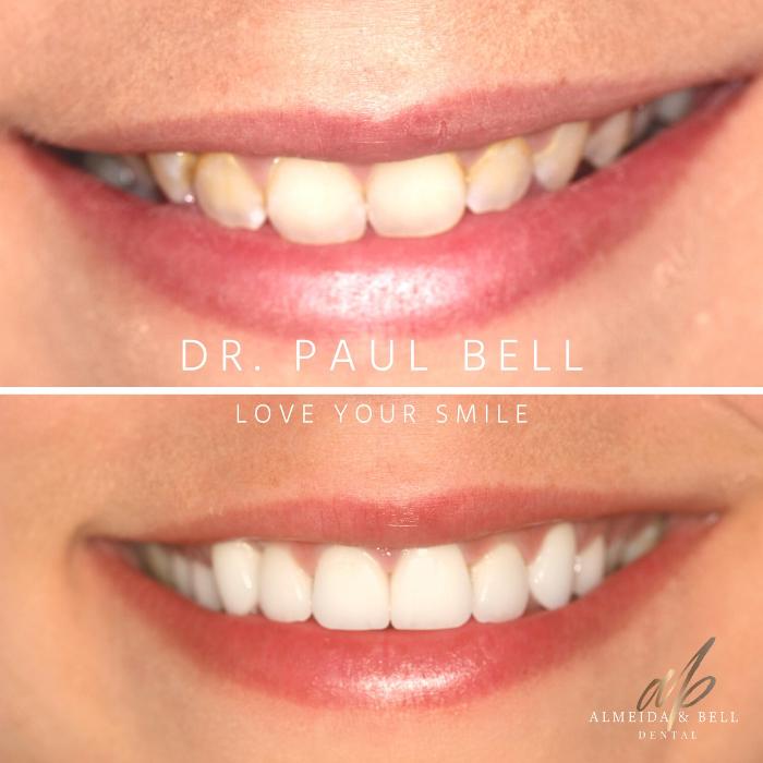 Almeida & Bell Dental Lone Tree - General, Cosmetic, and Implant Dentistry Image