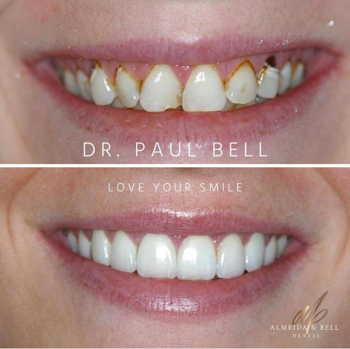 Almeida & Bell Dental Lone Tree - General, Cosmetic, and Implant Dentistry Image