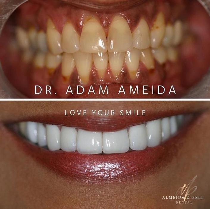 Almeida & Bell Dental Lone Tree - General, Cosmetic, and Implant Dentistry Image